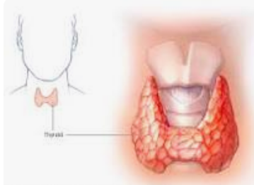 TI-RADS classification 