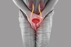 بی اختیاری ادرار در زنان_urinary incontinence